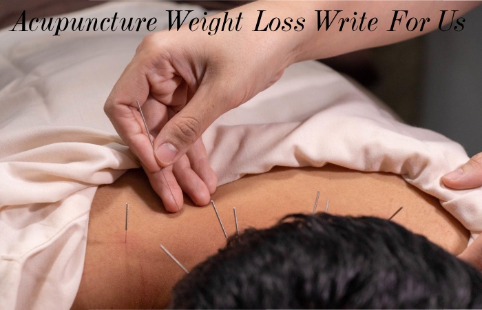 Acupuncture Weight Loss Write For Us