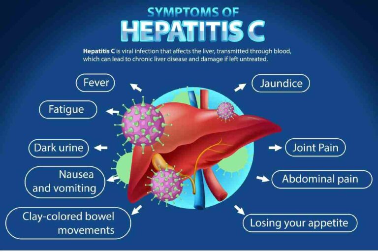 Hepatitis c symptoms – Benefits, Tips And More