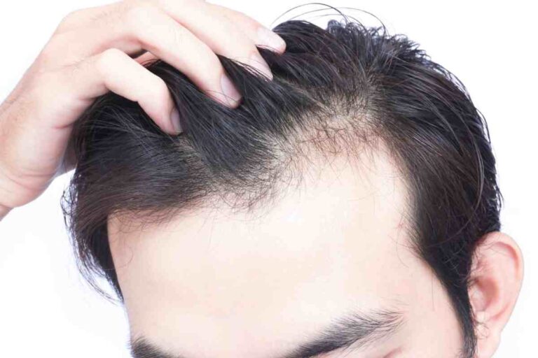 Does Creatine Cause Hair Loss? Science, Myths, and Facts Explained