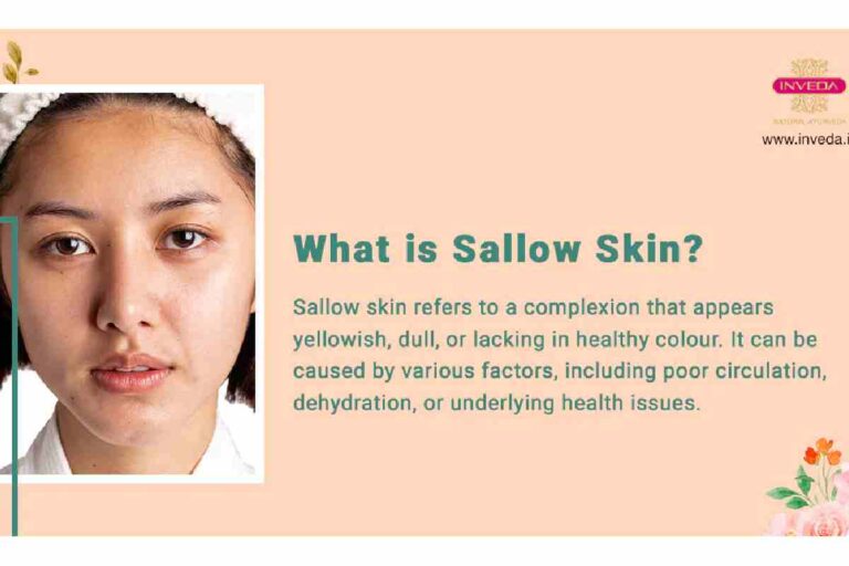 Sallow Skin – Causes And Deficiencies